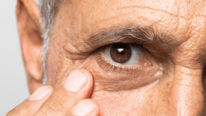 Revolutionary Cell Therapy for Damaged Corneas Unveiled